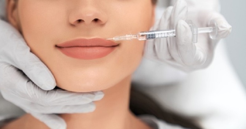 Kết quả của việc tiêm filler môi trên môi dày kéo dài được không?
